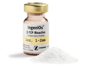 IngeniOs ß-TCP Partículas bioactivas de hueso sintetico de Zimmer Biomet dentaltvweb