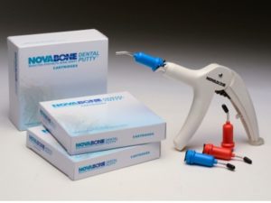 Novabone Dental Putty injerto oseo sintetico de NovaBone Products dentaltvweb