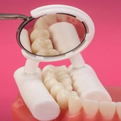 dentaltvweb_espejo_y_rollos_de_algodon