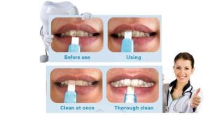 limpieza dental dentaltvweb