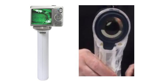 velscope_cancer dentaltvweb velscope_cancer dentaltvweb